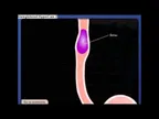 What is peristaltic movement? thumbnail